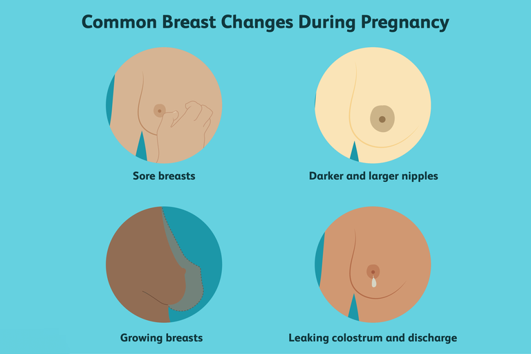 What Causes Tingling In Breasts And How To Deal With It?